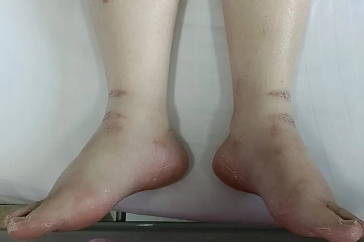 肾功能不好会出现什么样的状况