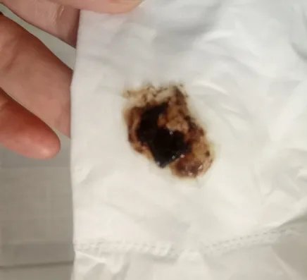 下面流黑色的脏东西图片