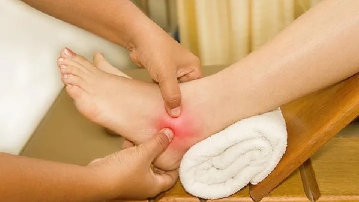 脚气的症状图片主要有哪些?脚气的原因