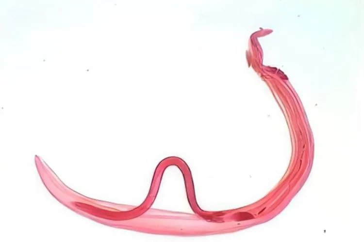 血吸虫肉眼图片