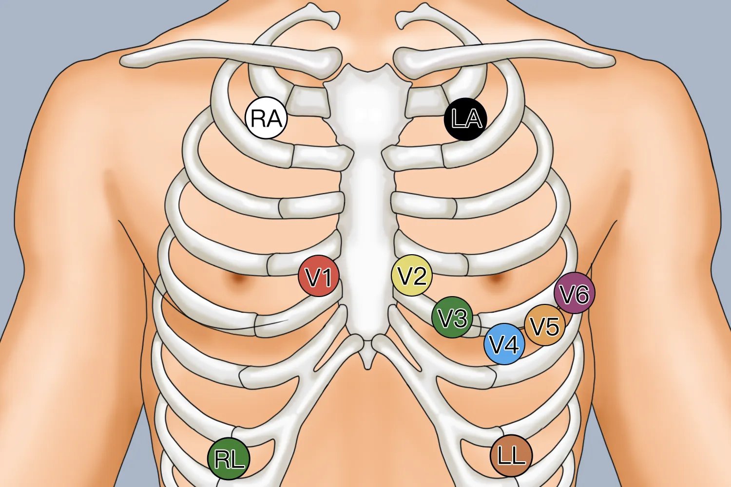 心电导联6个位置示意图