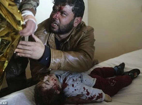 女婴被IS炸死 父亲怀抱15个月大女儿遗体痛哭