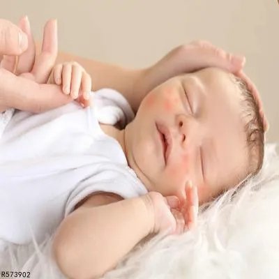 肤乐霜的作用 使用肤乐霜要注意什么