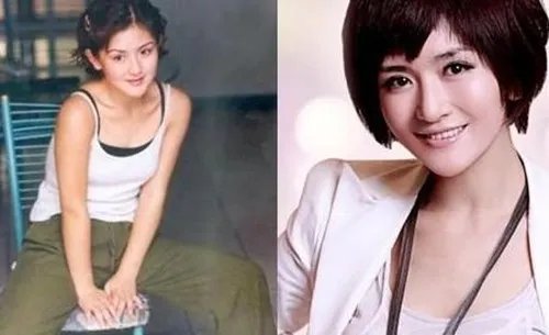 谢娜整容前后照片曝光 出道前后脸型差别大