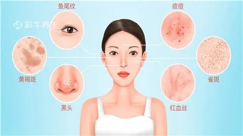 下巴反复长红肿硬硬的痘痘怎么办