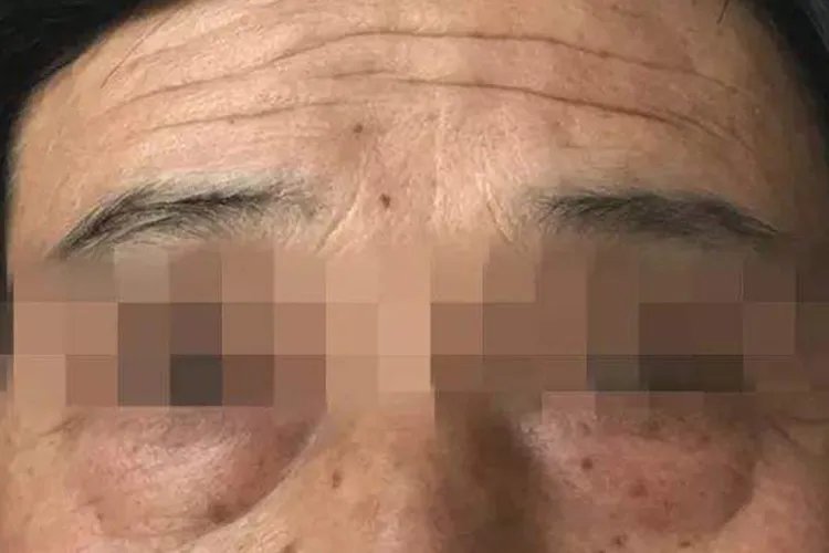 肾功能不好会出现什么样的状况