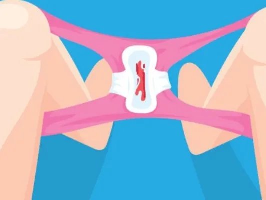 月经有血块是怎么回事？有3种情况5个注意事项