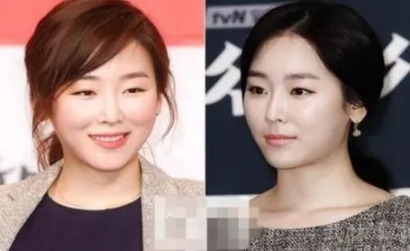 徐贤出道照片 徐贤真整容了吗