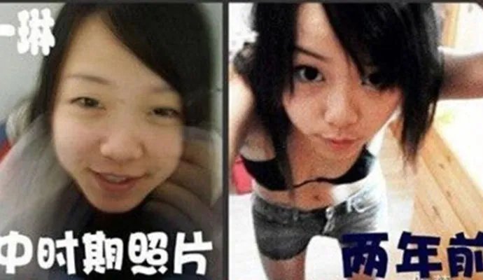 黄一琳以前照片 黄一琳承认整容怎么回事