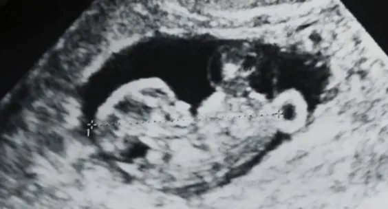 严屹宽将升级当爸了吗?