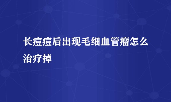 长痘痘后出现毛细血管瘤怎么治疗掉
