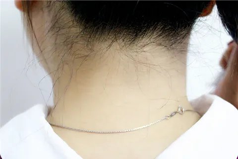 颈部淋巴结是什么问题