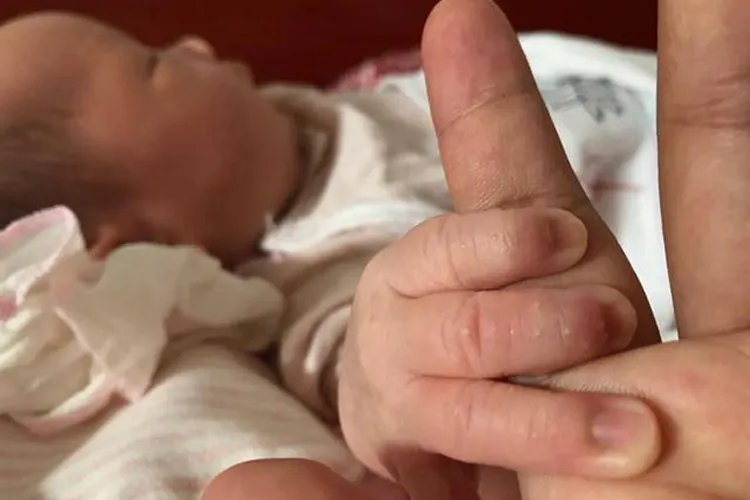 宝宝汗疱疹图片和症状图片