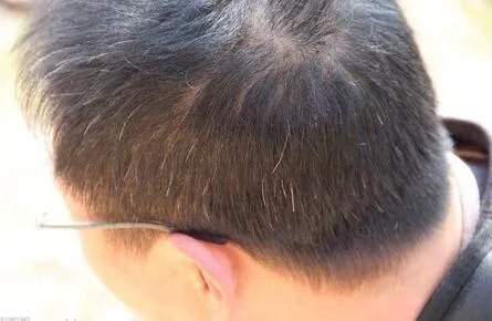 吃它让你到80岁都满头黑发：一头乌黑柔顺的黑发