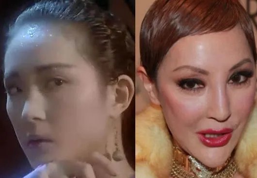 薛芷伦整容失败 前后对比太惊悚