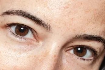 双眼皮离眉毛太近图片