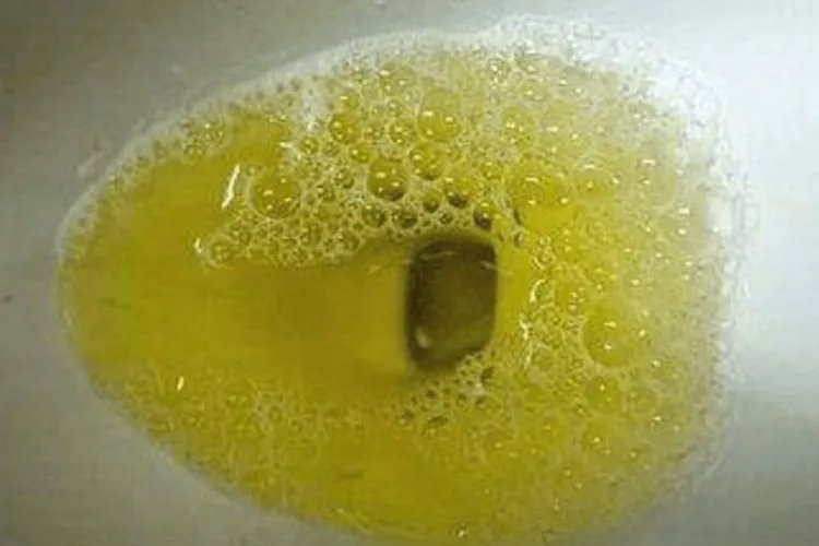 胆囊炎的症状是什么样的