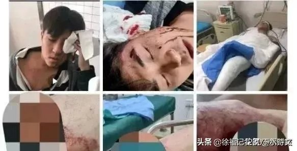 沈阳警方深夜通报研究生被刺伤案:要办成铁案,处理慢作为者, 你怎么看?