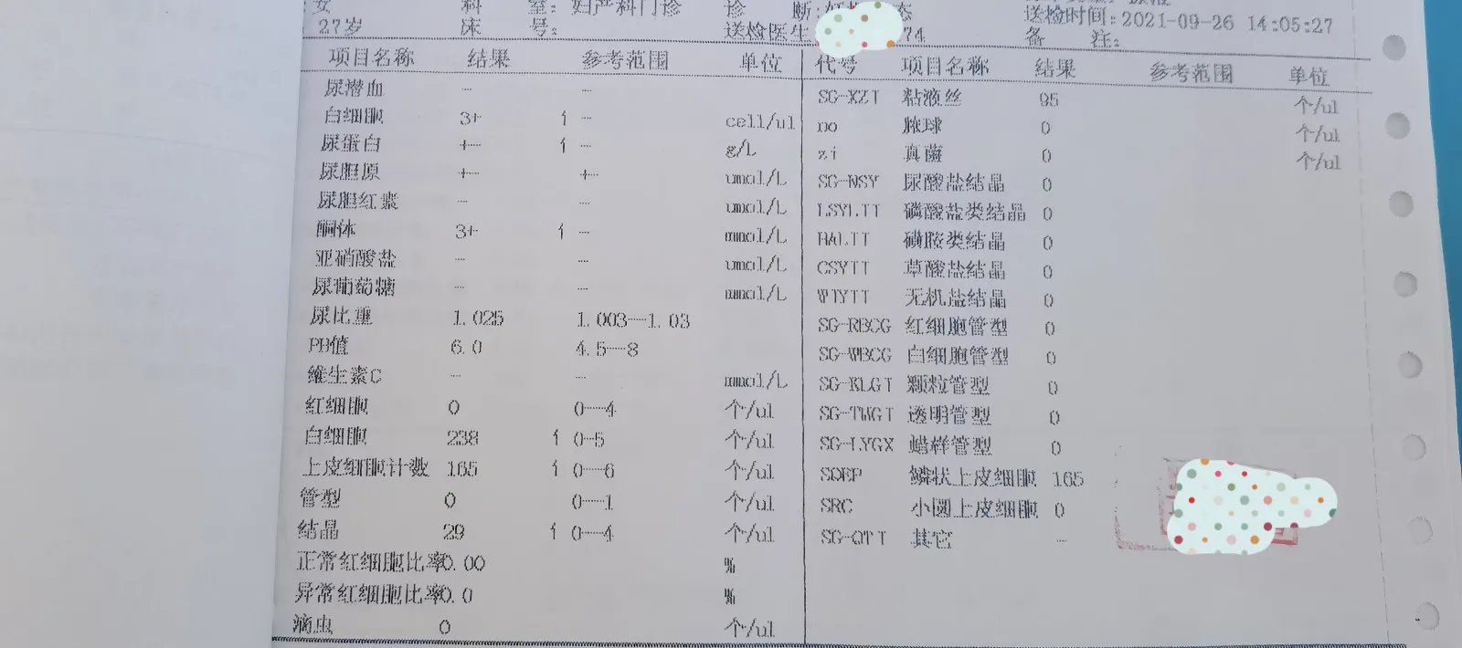 四个月胎儿图片
