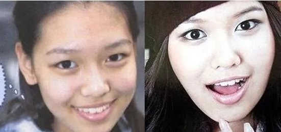 少女时代整容前后照片对比 少女时代为什么叫女帝