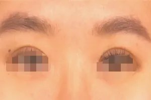 双眼皮有几种眼型图片