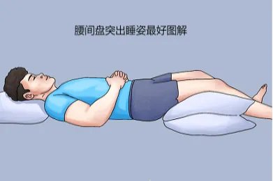 腰间盘突出什么睡姿最好图解