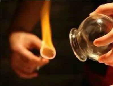 女子拔罐背部起火是怎么回事?