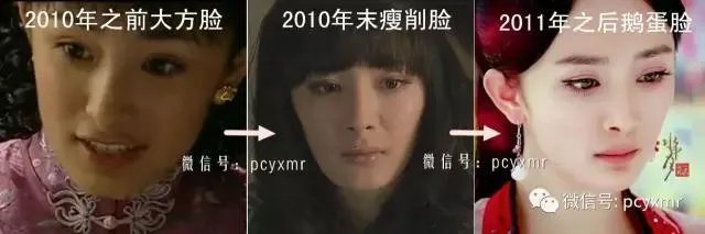 拔智齿真的可以瘦脸吗？有何依据？