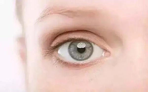 上海做双眼皮哪家整形医院口碑好