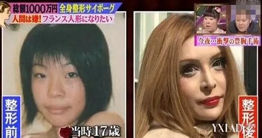 巴西男整容42次变真人肯尼全球疯狂整容案例盘点