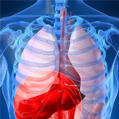 丙肝的主要症状?