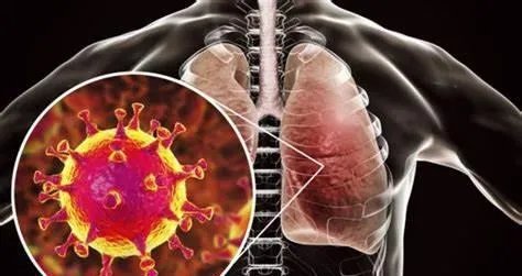 什么样的患者会被称为超级传播者，最早的超级传播者是谁？