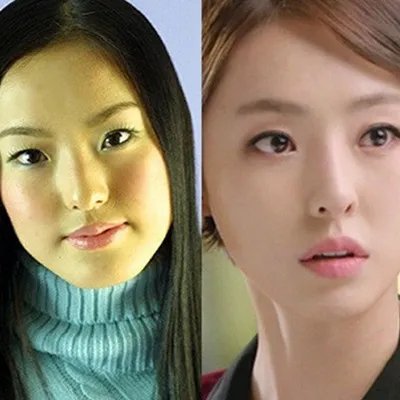 李宝英整容了吗？ 曾在报道中大方承认