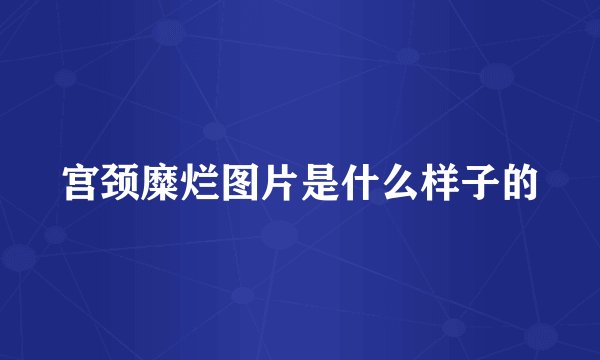 宫颈糜烂图片是什么样子的