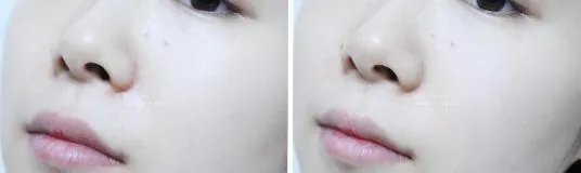 去死皮的哪种产品好？