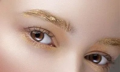 北京做双眼皮手术多少钱