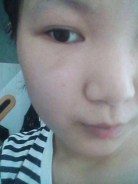 疤痕修复价格是怎样的