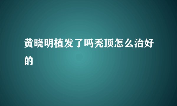 黄晓明植发了吗秃顶怎么治好的