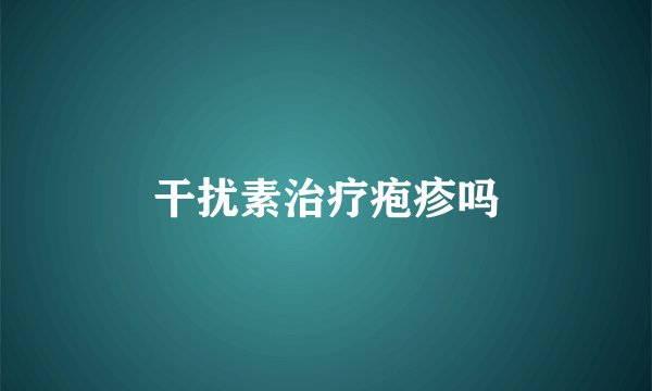 干扰素治疗疱疹吗