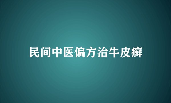 民间中医偏方治牛皮癣
