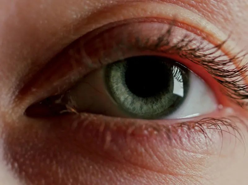 如何减少眼角皱纹