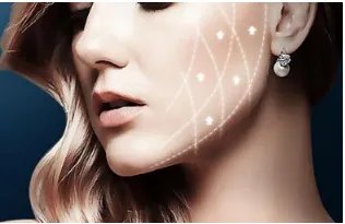 去医院祛痘要多少钱