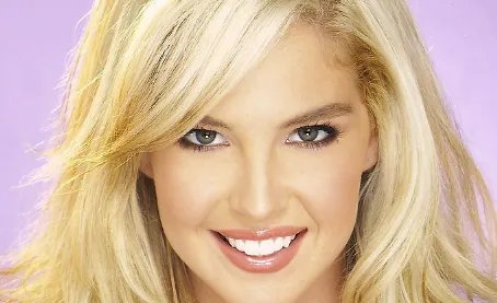 激光祛痘坑要多少钱