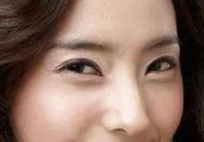 朝天鼻如何矫正