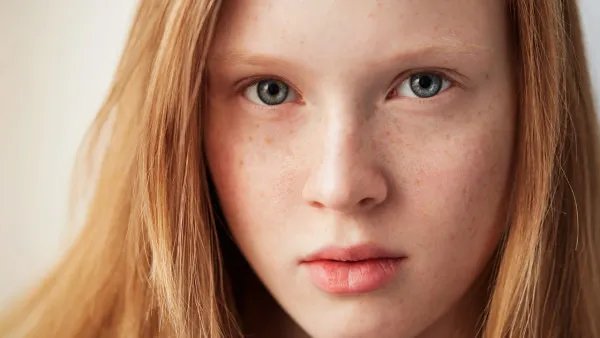 激光祛斑会留疤吗