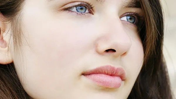 怎样去掉脸上的红血丝