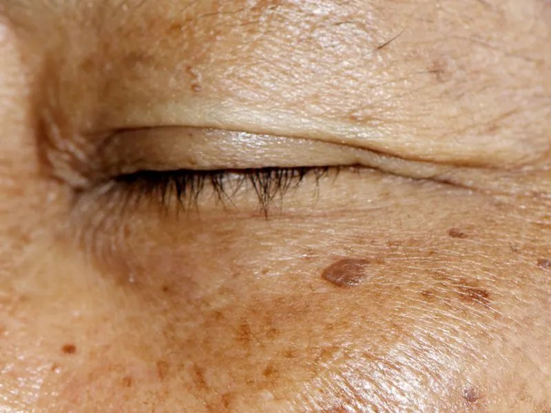 防老年斑怎么做