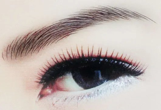 开内眼角手术多久可以恢复