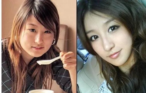 刘羽琦整容前后照片对比曝光    其承认自己整容