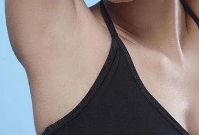 光子脱毛医院哪家较好